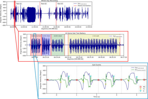 Zum Artikel "ID 2452: Neural Network-Based Detection of Gait Battery Tests in Unsupervised Home Recordings"