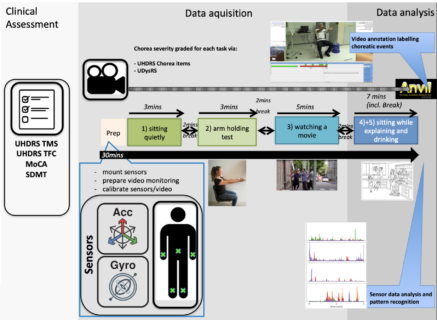 Zum Artikel "ID 2453: Monitoring prodromal hyperkinetic movements using body worn sensors in Huntington’s Disease"